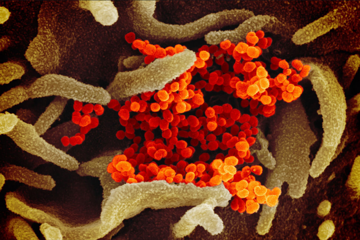 Novel Coronavirus SARS-CoV-2